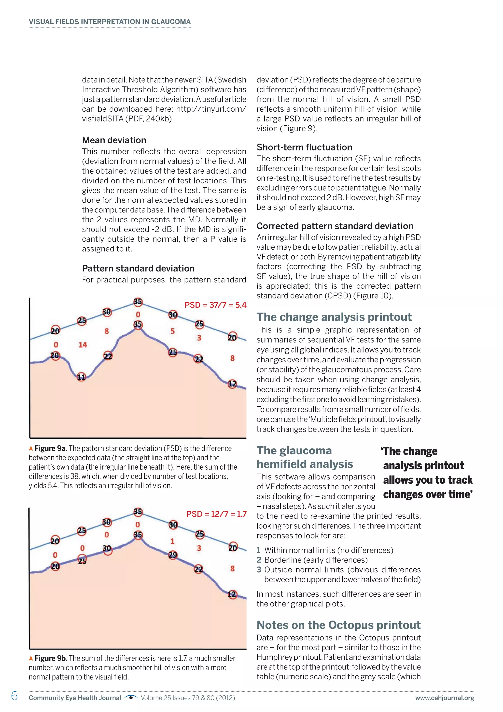 6 Community Eye Health Journal Volume 25 Issues 79 & 80 (2012) www.cehjournal.org
VISUAL FIELDS INTERPRETATION IN GLAUCOMA
dataindetail.NotethatthenewerSITA(Swedish
Interactive Threshold Algorithm) software has
justapatternstandarddeviation.Ausefularticle
can be downloaded here: http://tinyurl.com/
visfieldSITA (PDF, 240kb)
Mean deviation
This number reflects the overall depression
(deviation from normal values) of the field. All
the obtained values of the test are added, and
divided on the number of test locations. This
gives the mean value of the test. The same is
done for the normal expected values stored in
thecomputerdatabase.Thedifferencebetween
the 2 values represents the MD. Normally it
should not exceed -2 dB. If the MD is signifi-
cantly outside the normal, then a P value is
assigned to it.
Pattern standard deviation
For practical purposes, the pattern standard
deviation (PSD) reflects the degree of departure
(difference) of the measuredVFpattern (shape)
from the normal hill of vision. A small PSD
reflects a smooth uniform hill of vision, while
a large PSD value reflects an irregular hill of
vision (Figure 9).
Short-term fluctuation
The short-term fluctuation (SF) value reflects
difference in the response for certain test spots
onre-testing.Itisusedtorefinethetestresultsby
excludingerrorsduetopatientfatigue.Normally
it should not exceed 2 dB.However,high SFmay
be a sign of early glaucoma.
Corrected pattern standard deviation
An irregular hill of vision revealed by a high PSD
valuemaybeduetolowpatientreliability,actual
VFdefect,orboth.Byremovingpatientfatigability
factors (correcting the PSD by subtracting
SF value), the true shape of the hill of vision
is appreciated; this is the corrected pattern
standard deviation (CPSD) (Figure 10).
The change analysis printout
This is a simple graphic representation of
summaries of sequential VF tests for the same
eye using all global indices.It allows you to track
changesovertime,andevaluatetheprogression
(or stability) of the glaucomatous process.Care
should be taken when using change analysis,
becauseitrequiresmanyreliablefields(atleast4
excludingthefirstonetoavoidlearningmistakes).
Tocompareresultsfromasmallnumberoffields,
onecanusethe‘Multiplefieldsprintout’
,tovisually
track changes between the tests in question.
The glaucoma
hemifield analysis
This software allows comparison
of VFdefectsacrossthehorizontal
axis (looking for – and comparing
–nasalsteps).Assuchitalertsyou
to the need to re-examine the printed results,
lookingforsuchdifferences.Thethreeimportant
responses to look for are:
1 Within normal limits (no differences)
2 Borderline (early differences)
3 Outside normal limits (obvious differences
betweentheupperandlowerhalvesofthefield)
In most instances, such differences are seen in
the other graphical plots.
Notes on the Octopus printout
Data representations in the Octopus printout
are – for the most part – similar to those in the
Humphreyprintout.Patientandexaminationdata
areatthetopoftheprintout,followedbythevalue
table (numeric scale) and the grey scale (which
Figure 9a. The pattern standard deviation (PSD) is the difference
between the expected data (the straight line at the top) and the
patient’s own data (the irregular line beneath it). Here, the sum of the
differences is 38, which, when divided by number of test locations,
yields 5.4.This reflects an irregular hill of vision.
Figure 9b. The sum of the differences is here is 1.7, a much smaller
number, which reflects a much smoother hill of vision with a more
normal pattern to the visual field.
‘The change
analysis printout
allows you to track
changes over time’
PSD = 12/7 = 1.7
PSD = 37/7 = 5.4
 