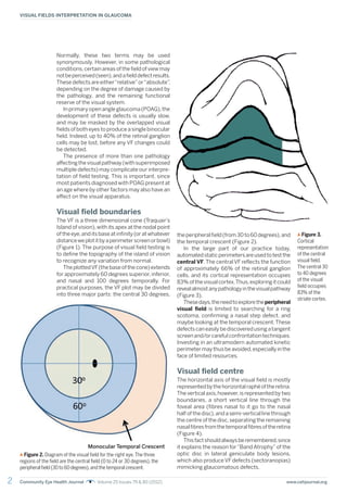 2 Community Eye Health Journal Volume 25 Issues 79 & 80 (2012) www.cehjournal.org
VISUAL FIELDS INTERPRETATION IN GLAUCOMA
Normally, these two terms may be used
synonymously. However, in some pathological
conditions,certain areas of the field of view may
notbeperceived(seen),andafielddefectresults.
These defects are either“relative”or“absolute”
,
depending on the degree of damage caused by
the pathology, and the remaining functional
reserve of the visual system.
In primary open angle glaucoma (POAG),the
development of these defects is usually slow,
and may be masked by the overlapped visual
fields of both eyes to produce a single binocular
field. Indeed, up to 40% of the retinal ganglion
cells may be lost, before any VF changes could
be detected.
The presence of more than one pathology
affectingthevisualpathway(withsuperimposed
multiple defects) may complicate our interpre-
tation of field testing. This is important, since
most patients diagnosed with POAG present at
an age where by other factors may also have an
effect on the visual apparatus.
Visual field boundaries
The VF is a three dimensional cone (Traquair’s
Island of vision),with its apex at the nodal point
of the eye,and its base at infinity (or at whatever
distanceweplotitbyaperimeterscreenorbowl)
(Figure 1). The purpose of visual field testing is
to define the topography of the island of vision
to recognize any variation from normal.
TheplottedVF(thebaseofthecone)extends
for approximately 60 degrees superior,inferior,
and nasal and 100 degrees temporally. For
practical purposes, the VF plot may be divided
into three major parts: the central 30 degrees,
theperipheralfield(from30to60degrees),and
the temporal crescent (Figure 2).
In the large part of our practice today,
automatedstaticperimetersareusedtotestthe
central VF.The central VF reflects the function
of approximately 66% of the retinal ganglion
cells, and its cortical representation occupies
83%ofthevisualcortex.Thus,exploringitcould
revealalmostanypathologyinthevisualpathway
(Figure 3).
Thesedays,theneedtoexploretheperipheral
visual field is limited to searching for a ring
scotoma, confirming a nasal step defect, and
maybe looking at the temporal crescent.These
defectscaneasilybediscoveredusingatangent
screenand/orcarefulconfrontationtechniques.
Investing in an ultramodern automated kinetic
perimetermaythusbeavoided,especiallyinthe
face of limited resources.
Visual field centre
The horizontal axis of the visual field is mostly
representedbythehorizontalraphéoftheretina.
The vertical axis,however,is represented by two
boundaries, a short vertical line through the
foveal area (fibres nasal to it go to the nasal
half of the disc),and a semi-vertical line through
the centre of the disc,separating the remaining
nasalfibresfromthetemporalfibresoftheretina
(Figure 4).
Thisfactshouldalwaysberemembered,since
it explains the reason for“Band Atrophy”of the
optic disc in lateral geniculate body lesions,
which also produce VF defects (sectoranopias)
mimicking glaucomatous defects.
Figure 2. Diagram of the visual field for the right eye.The three
regions of the field are the central field (0 to 24 or 30 degrees), the
peripheral field (30 to 60 degrees),and the temporal crescent.
Figure 3.
Cortical
representation
of the central
visual field.
The central 30
to 40 degrees
of the visual
field occupies
83% of the
striate cortex.
Monocular Temporal Crescent
 