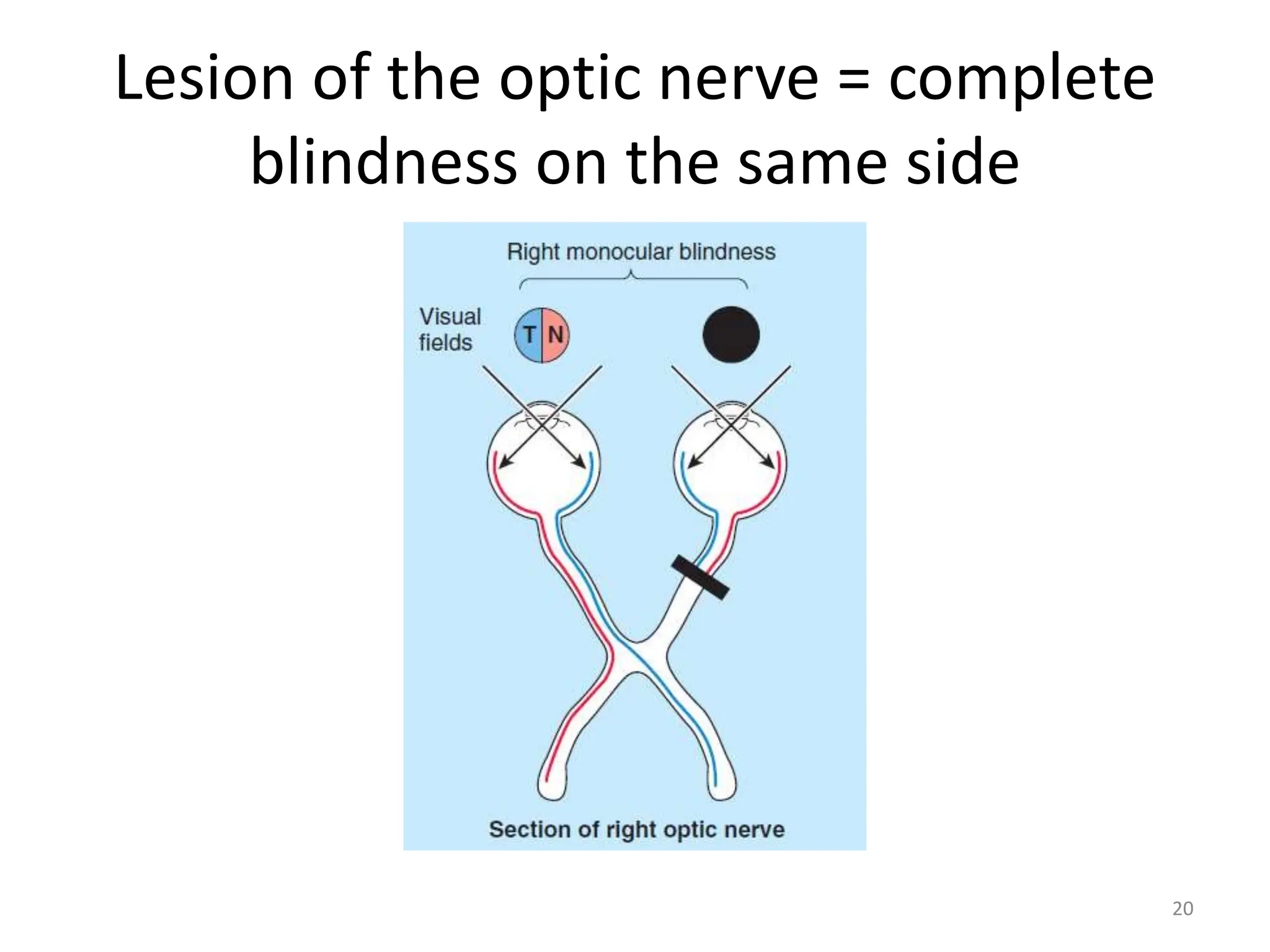 VISUAL FIELD AND PATHWAY (Neuroanatomy). | PPT