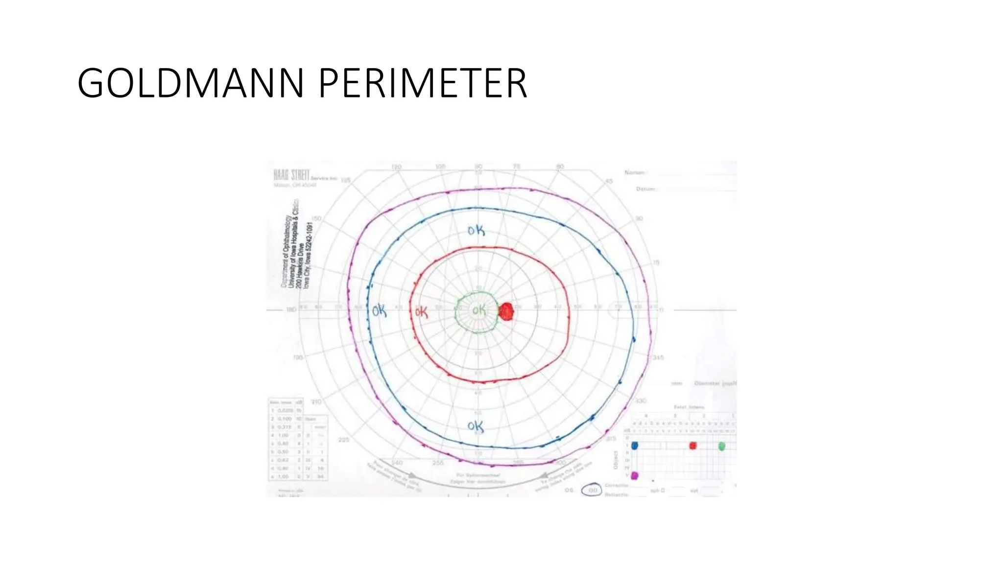 GOLDMANN PERIMETER
 