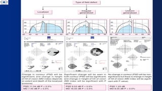 VISUAL FIELDS . BASICS OF VISUAL FIELDS AND ITS INTERPRETATION | PPTX