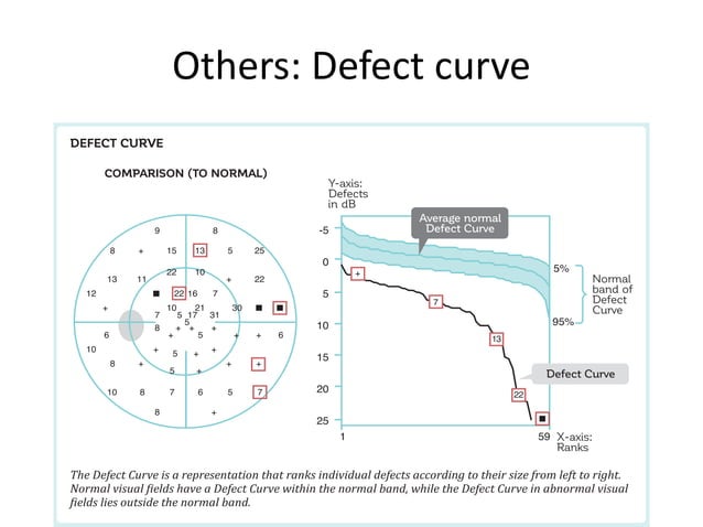 Visual Field Ref Interpretation of visual fields with special reference to octopus | PDF