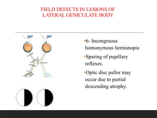 visual fields in neuro ophthalmology-part 1 | PPTX