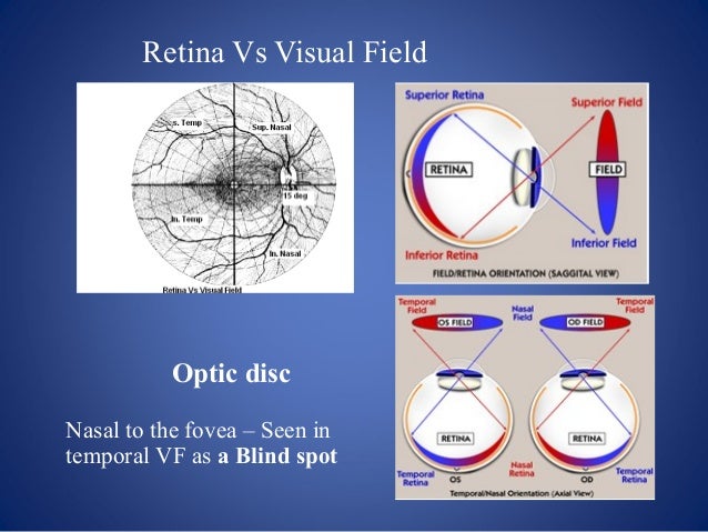 Visual field testing and interpretation