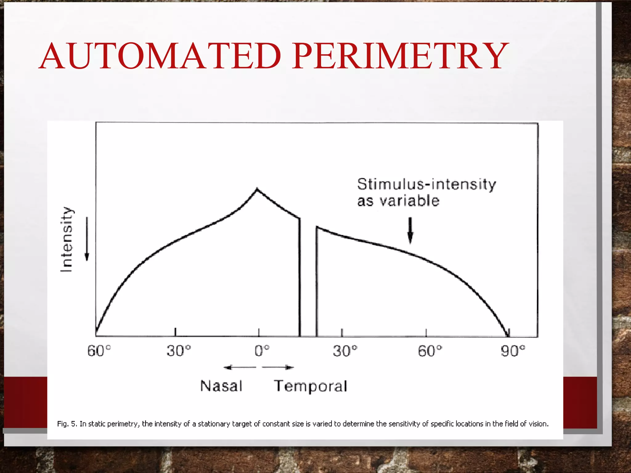 Visual field testing and interpretation | PPT