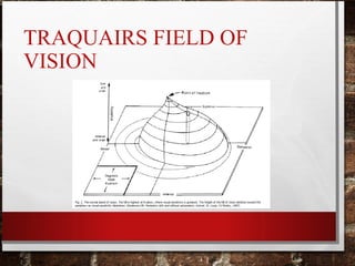 TRAQUAIRS FIELD OF
VISION
 