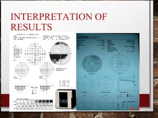 INTERPRETATION OF
RESULTS
 