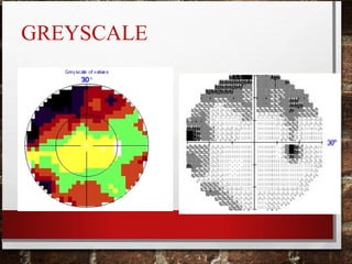 GREYSCALE
 