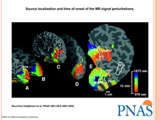 Visual hallucinations: Differential diagnosis & treatment