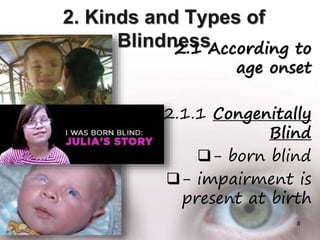 2. Kinds and Types of
Blindness2.1 According to
age onset
2.1.1 Congenitally
Blind
- born blind
- impairment is
present at birth
8
 