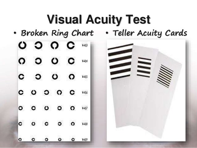 Teller Acuity Chart