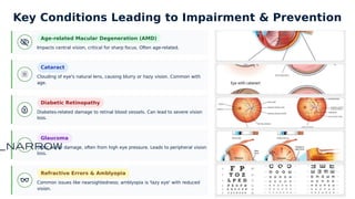 visual impairment_-meaning_-cause_- type.pptx