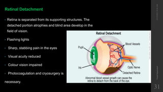 Retinal Detachment
• Retina is separated from its supporting structures. The
detached portion atrophies and blind area develop in the
field of vision.
• Flashing lights
• Sharp, stabbing pain in the eyes
• Visual acuity reduced
• Colour vision impaired
• Photocoagulation and cryosurgery is
necessary.
12/19/2022
10:56
AM
Visual
Impairment
31
 