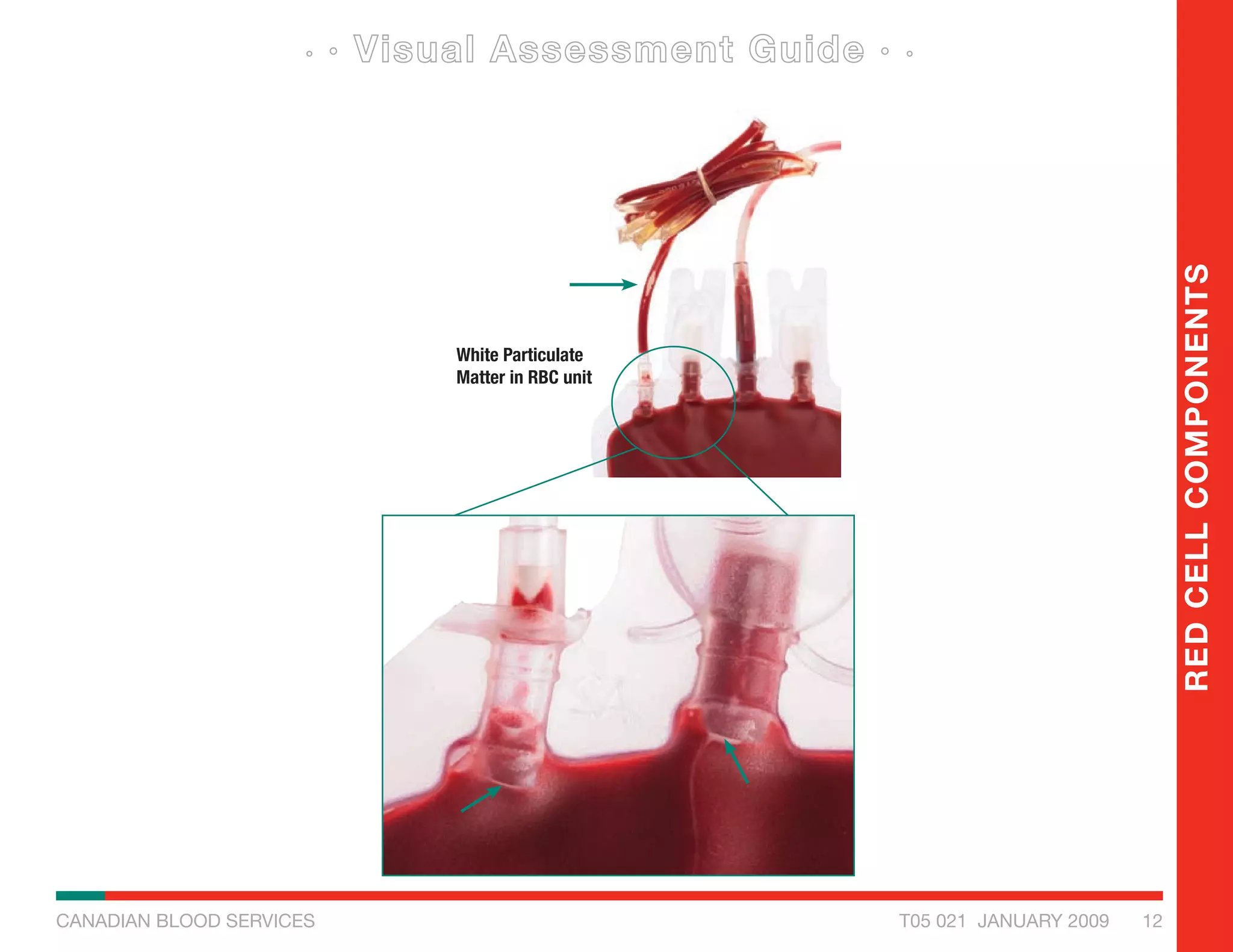 Visual Blood Testing Visual inspection guide for blood compopnents | PDF
