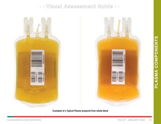 PLASMACOMPONENTS
CANADIAN BLOOD SERVICES 20
Examples of a Typical Plasma prepared from whole blood
T05 021 JANUARY 2009
 