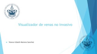 Visualizador de venas no invasivo
 Vianca lizbeth Moreno Sanchez
 