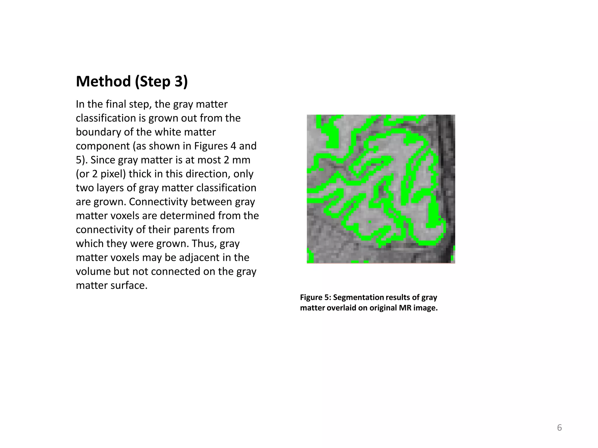 Method (Step 3)
In the final step, the gray matter
classification is grown out from the
boundary of the white matter
component (as shown in Figures 4 and
5). Since gray matter is at most 2 mm
(or 2 pixel) thick in this direction, only
two layers of gray matter classification
are grown. Connectivity between gray
matter voxels are determined from the
connectivity of their parents from
which they were grown. Thus, gray
matter voxels may be adjacent in the
volume but not connected on the gray
matter surface.
                                             Figure 5: Segmentation results of gray
                                             matter overlaid on original MR image.




                                                                                      6
 