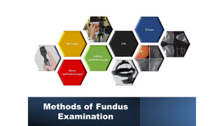 Methods of Fundus
Examination
 