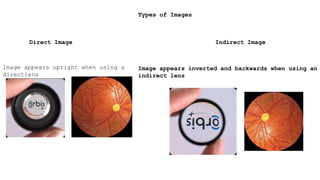 Types of Images
Direct Image
Image appears upright when using a
directlens
Indirect Image
Image appears inverted and backwards when using an
indirect lens
 