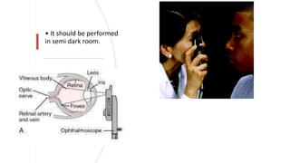 • It should be performed
in semi dark room.
 