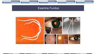Examine Fundus
 