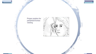 Proper position for
peripheral fundus
viewing
 