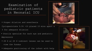 Examination of
pediatric patients
in Neonatal ICU
• Proper dilation and anesthesia
Cyclopentolate 0.5% -1% placed 10 mins apart x
3 for adequate dilation
• Sterile speculum for each eye and pediatric
depressors
• 28 D or 20 D indirect lenses can be used to
view the fundus
• Adequate positioning of the infant with help
 