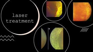laser
treatment
 