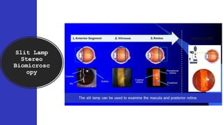 Slit Lamp
Stereo
Biomicrosc
opy
 