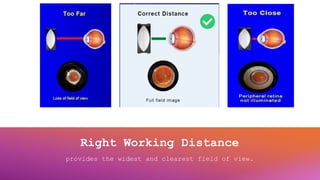 Right Working Distance
provides the widest and clearest field of view.
 