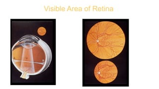 Visible Area of Retina
 