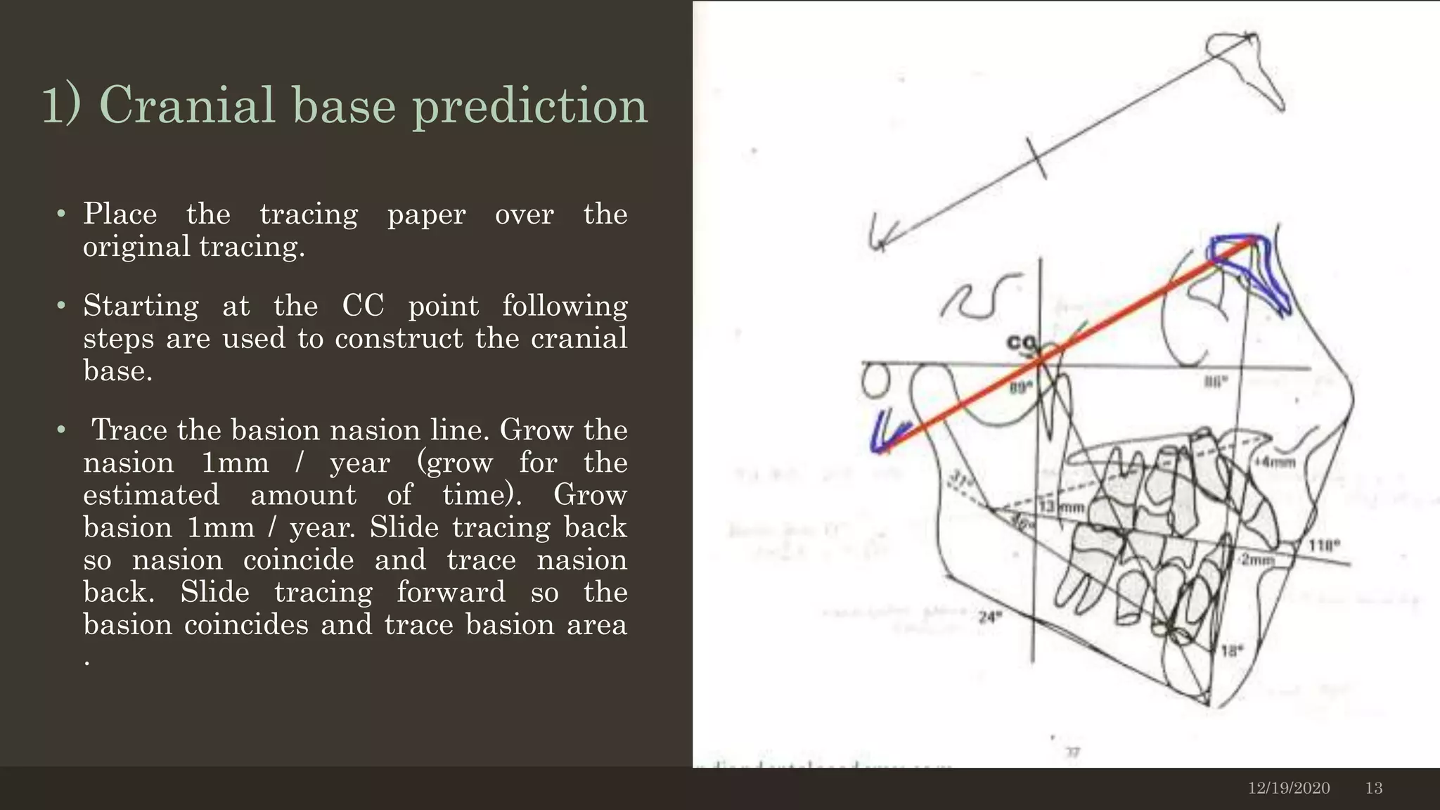 1) Cranial base prediction
• Place the tracing paper over the
original tracing.
• Starting at the CC point following
steps are used to construct the cranial
base.
• Trace the basion nasion line. Grow the
nasion 1mm / year (grow for the
estimated amount of time). Grow
basion 1mm / year. Slide tracing back
so nasion coincide and trace nasion
back. Slide tracing forward so the
basion coincides and trace basion area
.
12/19/2020 13
 