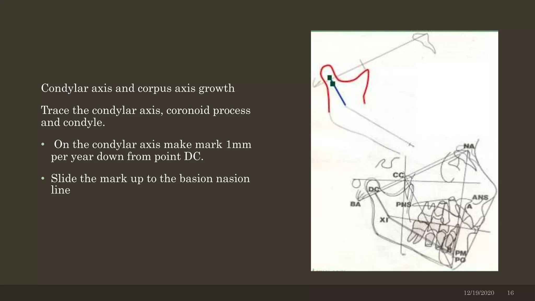 Condylar axis and corpus axis growth
Trace the condylar axis, coronoid process
and condyle.
• On the condylar axis make mark 1mm
per year down from point DC.
• Slide the mark up to the basion nasion
line
12/19/2020 16
 
