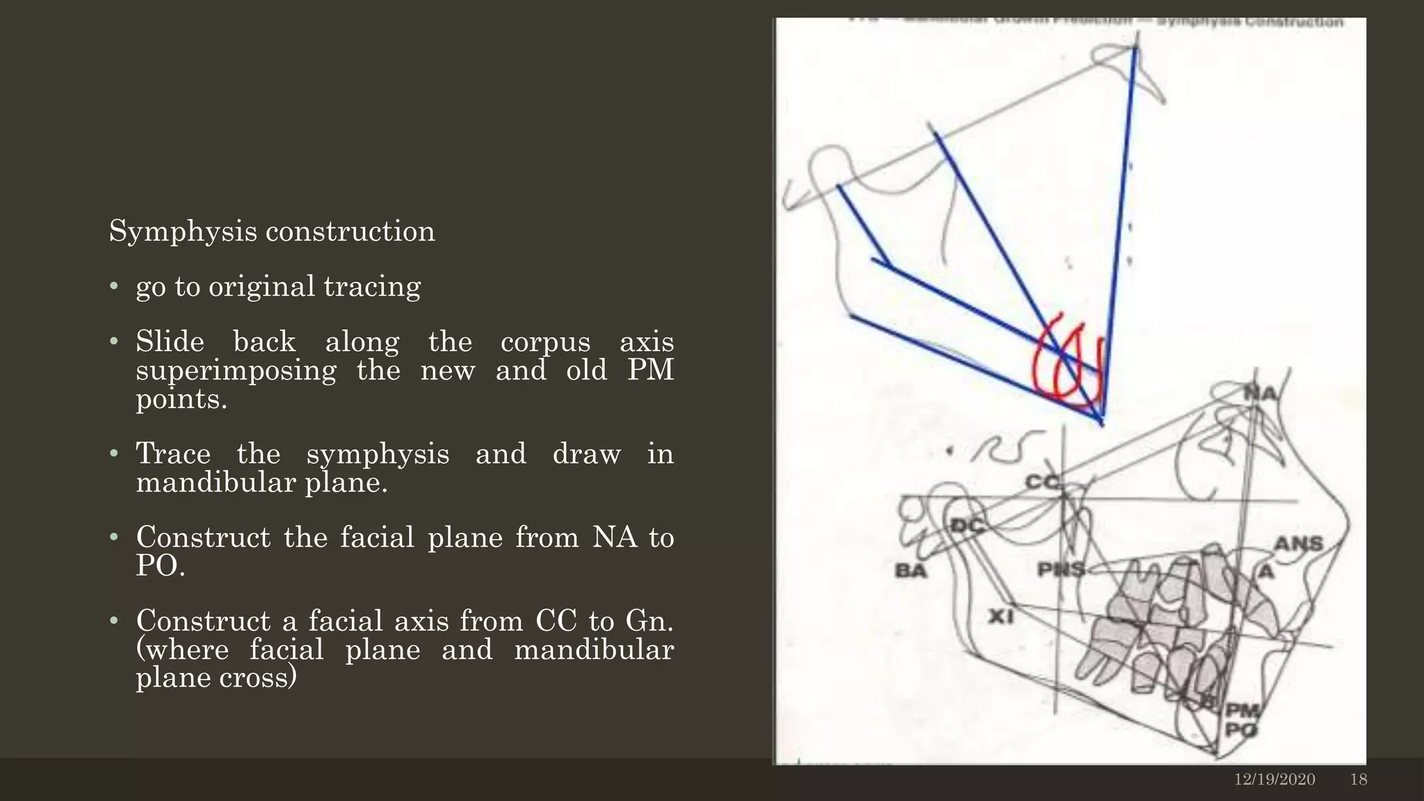 Symphysis construction
• go to original tracing
• Slide back along the corpus axis
superimposing the new and old PM
points.
• Trace the symphysis and draw in
mandibular plane.
• Construct the facial plane from NA to
PO.
• Construct a facial axis from CC to Gn.
(where facial plane and mandibular
plane cross)
12/19/2020 18
 