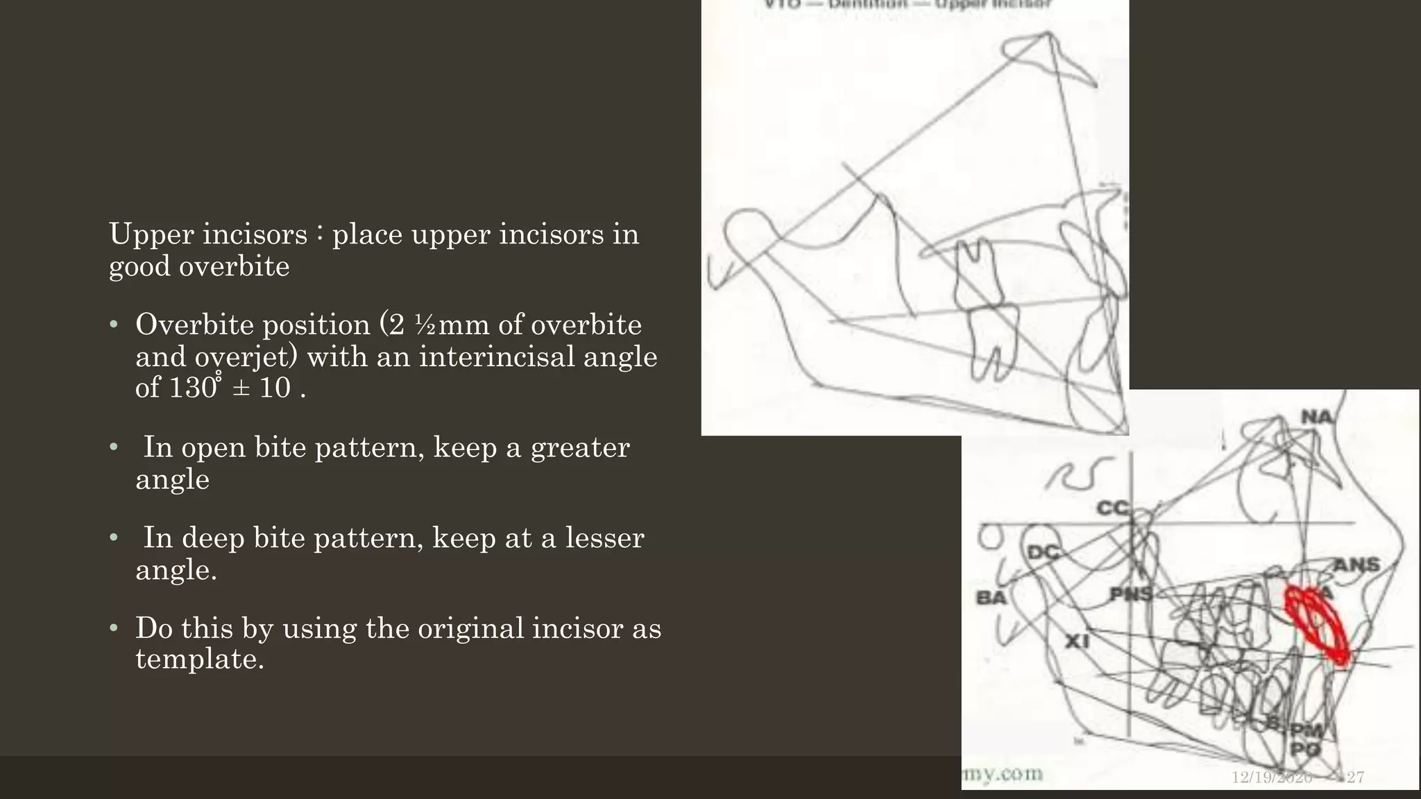 Upper incisors : place upper incisors in
good overbite
• Overbite position (2 ½mm of overbite
and overjet) with an interincisal angle
of 130 ̊̊ ± 10 .
• In open bite pattern, keep a greater
angle
• In deep bite pattern, keep at a lesser
angle.
• Do this by using the original incisor as
template.
12/19/2020 27
 