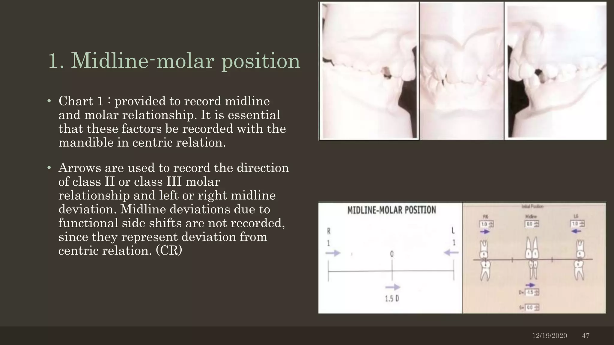 1. Midline-molar position
• Chart 1 : provided to record midline
and molar relationship. It is essential
that these factors be recorded with the
mandible in centric relation.
• Arrows are used to record the direction
of class II or class III molar
relationship and left or right midline
deviation. Midline deviations due to
functional side shifts are not recorded,
since they represent deviation from
centric relation. (CR)
12/19/2020 47
 