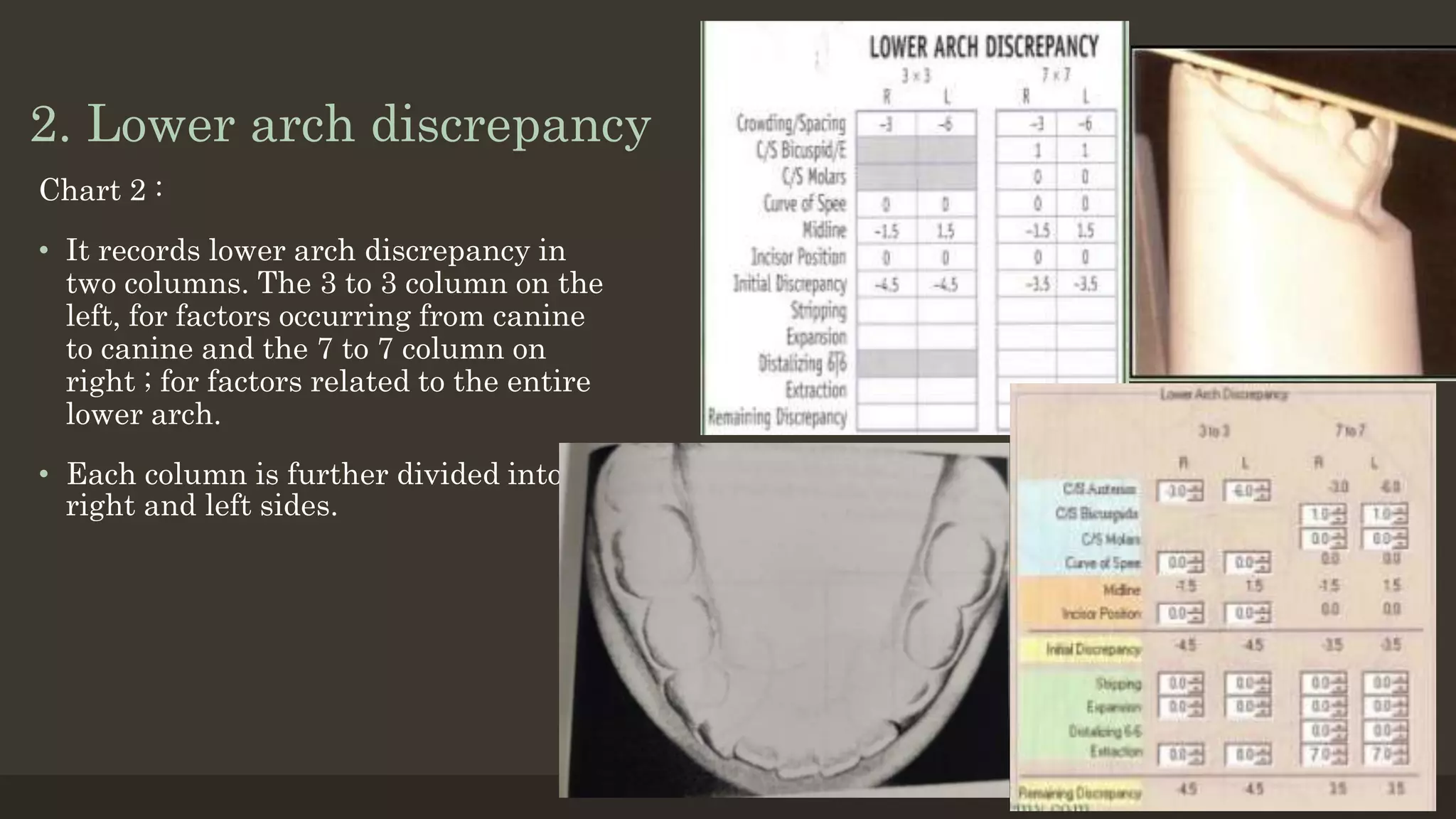 2. Lower arch discrepancy
Chart 2 :
• It records lower arch discrepancy in
two columns. The 3 to 3 column on the
left, for factors occurring from canine
to canine and the 7 to 7 column on
right ; for factors related to the entire
lower arch.
• Each column is further divided into
right and left sides.
12/19/2020 48
 