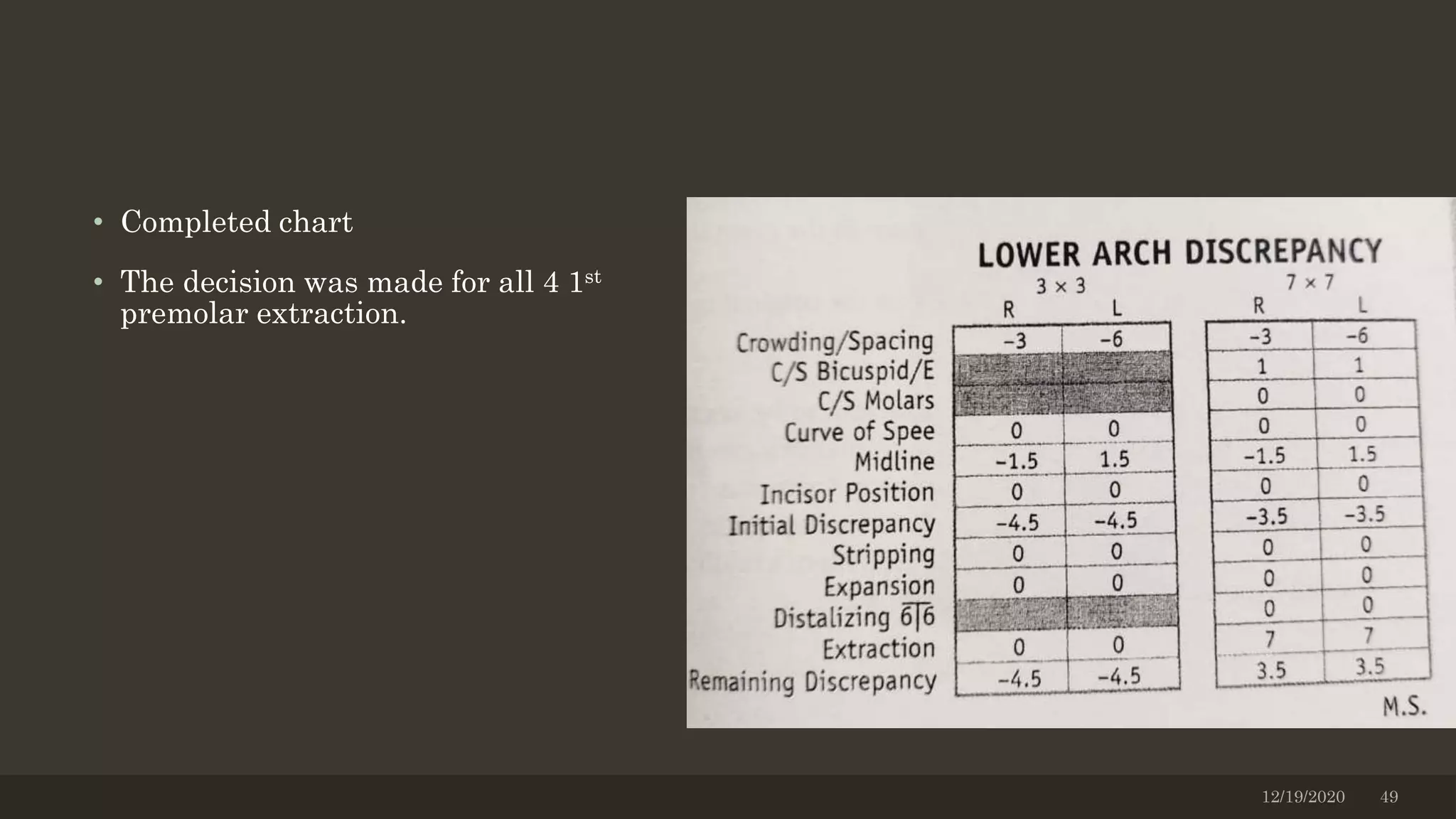 • Completed chart
• The decision was made for all 4 1st
premolar extraction.
12/19/2020 49
 