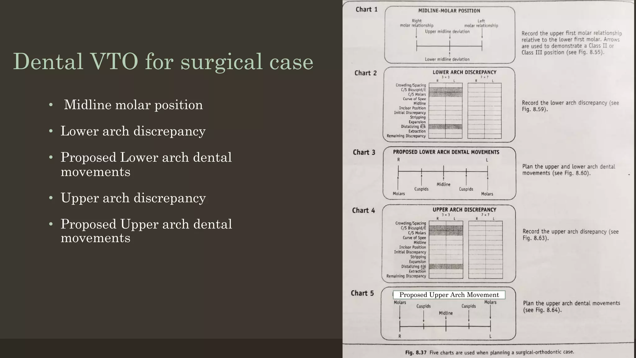 Dental VTO for surgical case
• Midline molar position
• Lower arch discrepancy
• Proposed Lower arch dental
movements
• Upper arch discrepancy
• Proposed Upper arch dental
movements
Proposed Upper Arch Movement
 