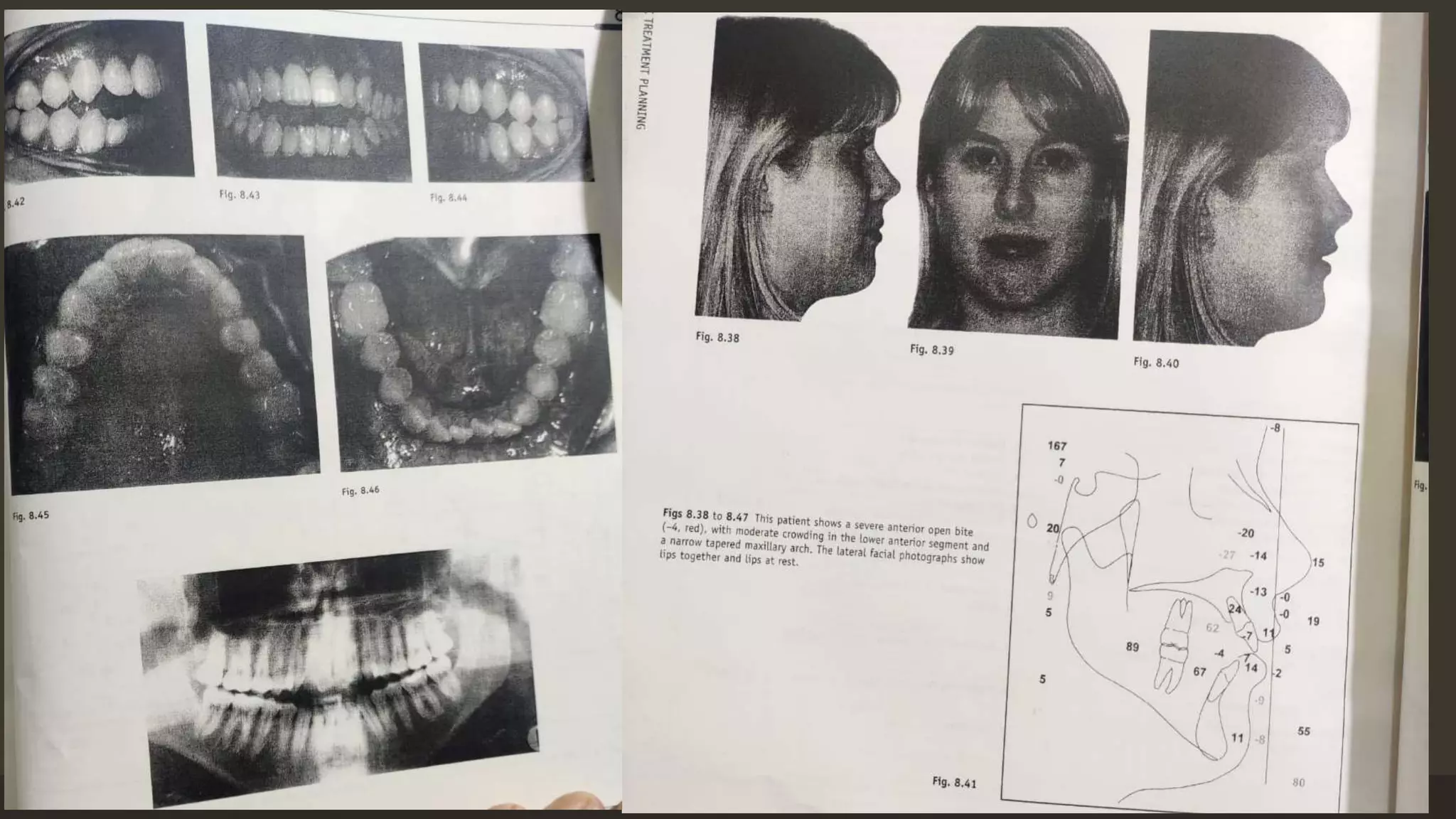 12/19/2020 55
12/19/2020 55
 