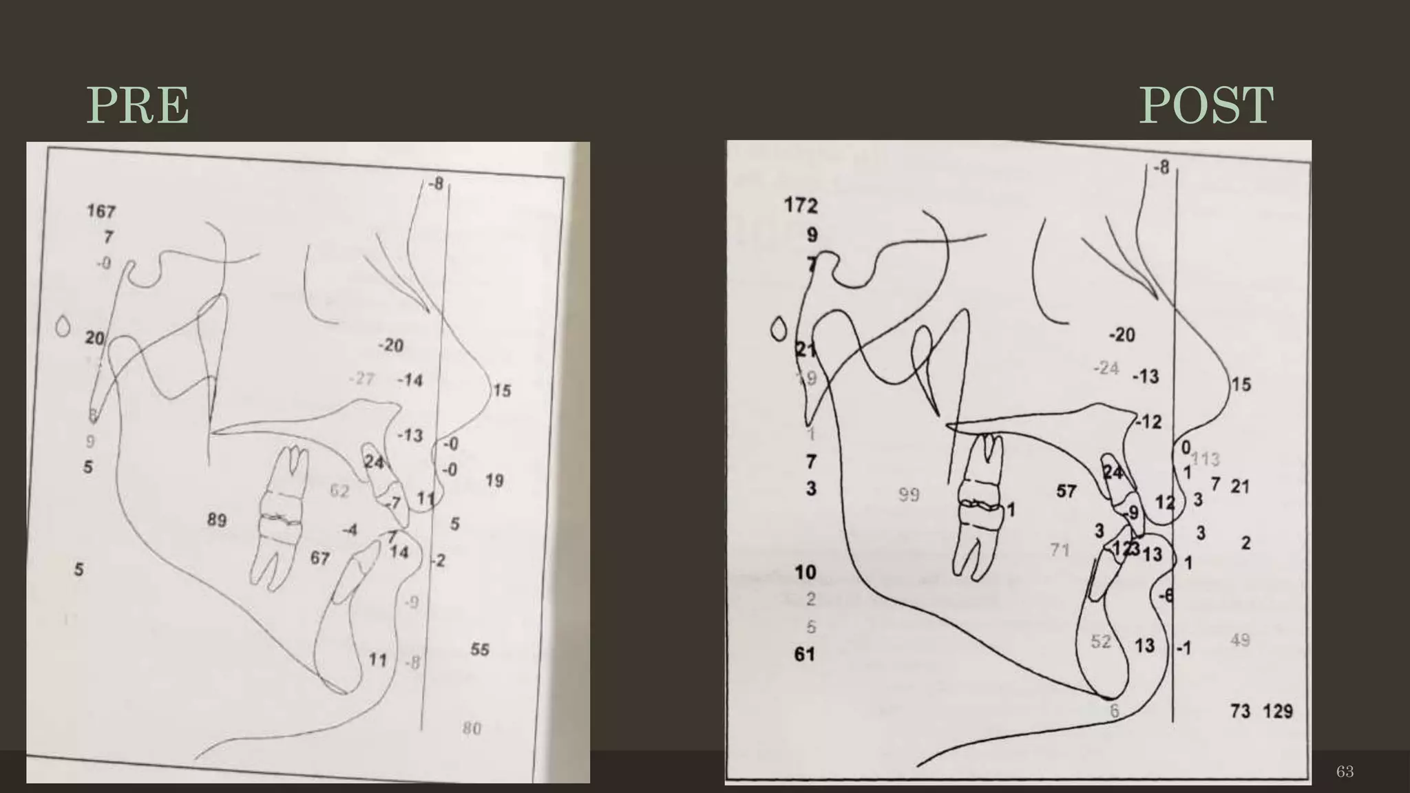 PRE POST
12/19/2020 63
 