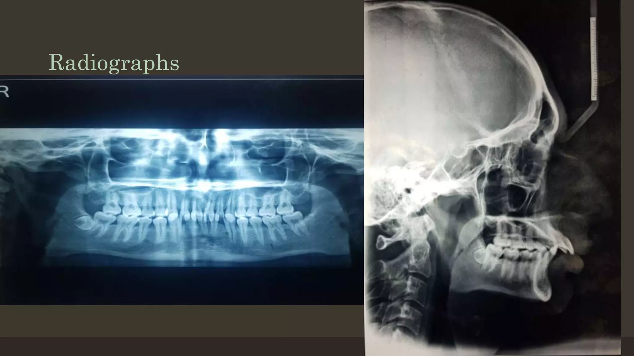 Radiographs
12/19/2020 83
 