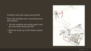 Condylar axis and corpus axis growth
Trace the condylar axis, coronoid process
and condyle.
• On the condylar axis make mark 1mm
per year down from point DC.
• Slide the mark up to the basion nasion
line
12/19/2020 16
 