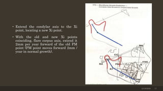 • Extend the condylar axis to the Xi
point, locating a new Xi point.
• With the old and new Xi points
coinciding, flare corpus axis, extend it
2mm per year forward of the old PM
point (PM point moves forward 2mm /
year in normal growth).
12/19/2020 17
 