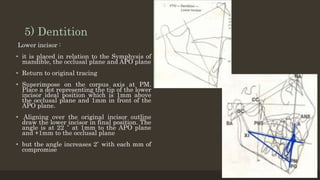 5) Dentition
Lower incisor :
• it is placed in relation to the Symphysis of
mandible, the occlusal plane and APO plane
• Return to original tracing
• Superimpose on the corpus axis at PM.
Place a dot representing the tip of the lower
incisor ideal position which is 1mm above
the occlusal plane and 1mm in front of the
APO plane.
• Aligning over the original incisor outline
draw the lower incisor in final position. The
angle is at 22 ̊ at 1mm to the APO plane
and +1mm to the occlusal plane
• but the angle increases 2 ̊ with each mm of
compromise
12/19/2020 24
 