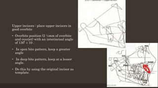 Upper incisors : place upper incisors in
good overbite
• Overbite position (2 ½mm of overbite
and overjet) with an interincisal angle
of 130 ̊̊ ± 10 .
• In open bite pattern, keep a greater
angle
• In deep bite pattern, keep at a lesser
angle.
• Do this by using the original incisor as
template.
12/19/2020 27
 