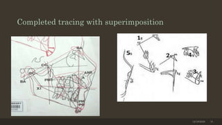 Completed tracing with superimposition
12/19/2020 31
 