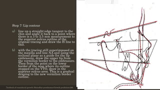Step 7: Lip contour
a) line up a straight-edge tangent to the
chin and angle it back to a point where
there is a 3 to 3.5 mm measurement to
the superior sulcus outline of the
original tracing and draw the H line to
this.
b) with the tracing still superimposed on
the maxilla and line NA and using the
occlusal plane as a guide for the lip
embrasure, draw the upper lip from
the vermilion border to the embrasure.
Then from the point on the lower
border of the nose where its outline
stopped on the VTO, draw in the
superior sulcus area. This is a gradual
draping to the new vermilion border
outline.
Textbook of craniofacial growth; Shreedhar premkumar;Growth prediction;206 12/19/2020 35
 