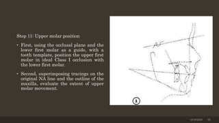 Step 11: Upper molar position
• First, using the occlusal plane and the
lower first molar as a guide, with a
tooth template, position the upper first
molar in ideal Class I occlusion with
the lower first molar.
• Second, superimposing tracings on the
original NA line and the outline of the
maxilla, evaluate the extent of upper
molar movement.
12/19/2020 39
 