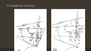 Completed tracing
12/19/2020 41
 